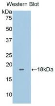 Active Fibronectin Type III Domain Containing Protein 5 (FNDC5)